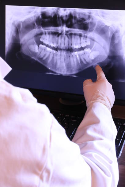 Best Emergency Dentist for Knocked-Out Tooth in Montclair, VA